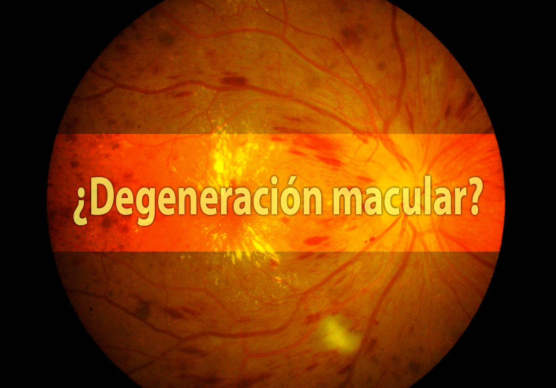 Degeneracin Macular