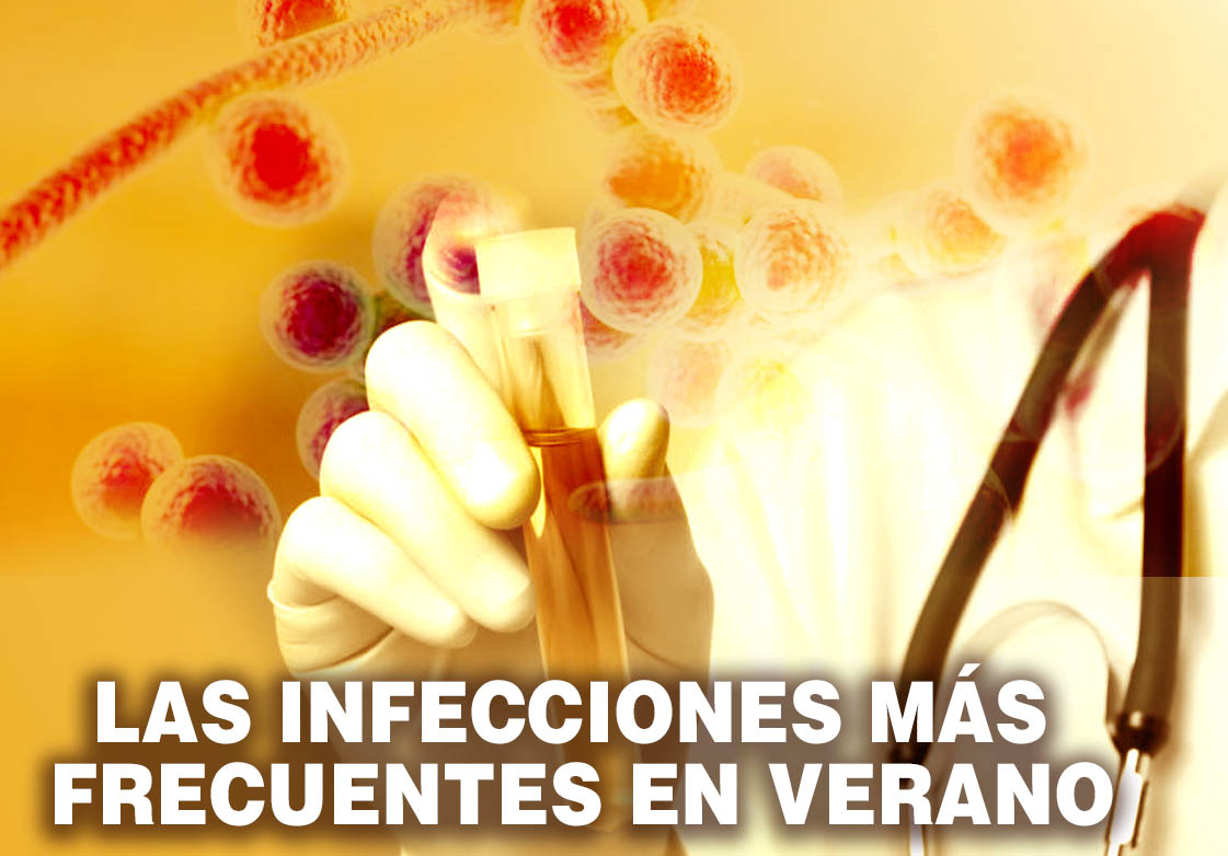 LAS INFECCIONES MS FRECUENTES EN VERANO